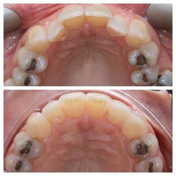 Patient smile result 1