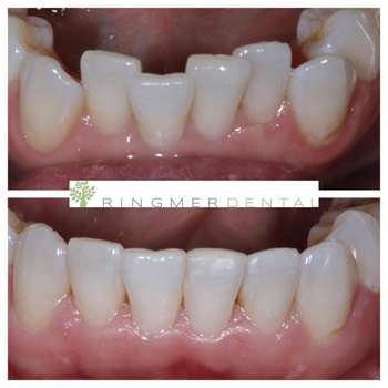 Patient smile result 3