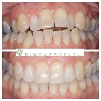 Patient smile result 2